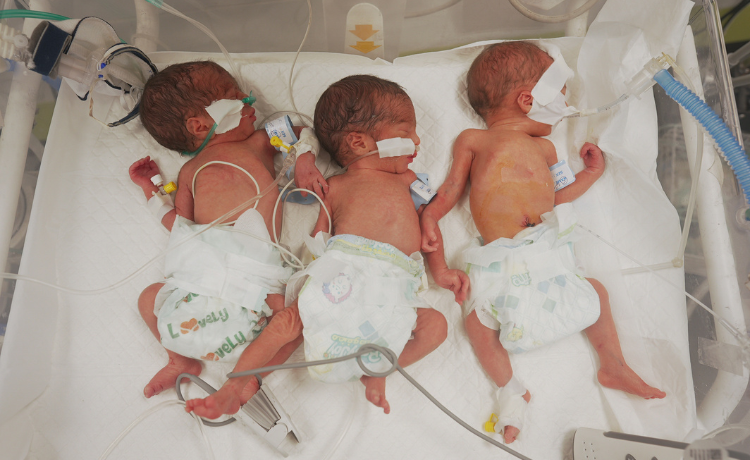 Three premature babies in nappies lie side-by-side in an incubator, attached to tubes and wires