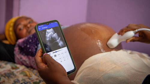 A woman receives an ultrasound. 