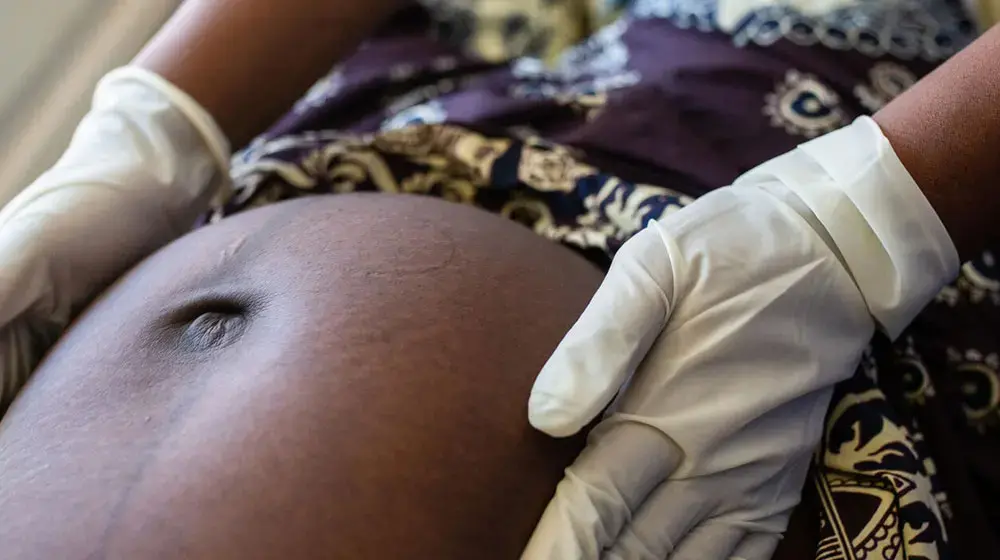 Obstetric fistula